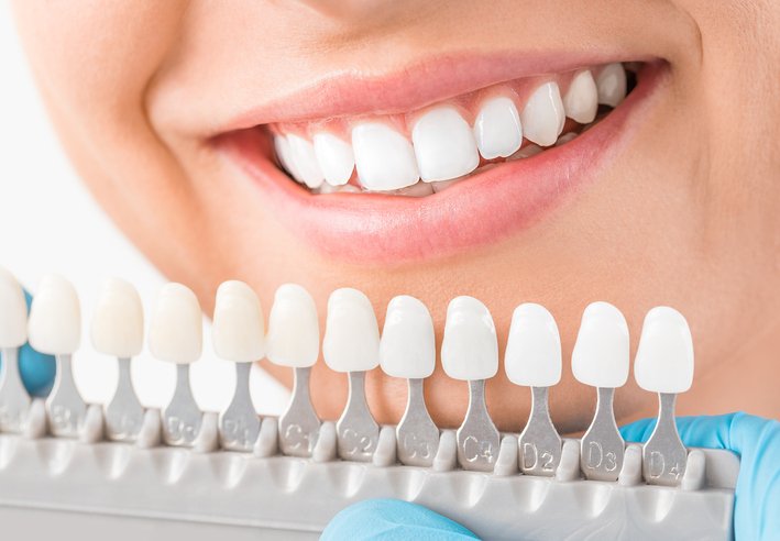 What Is Cosmetic Dental Treatment